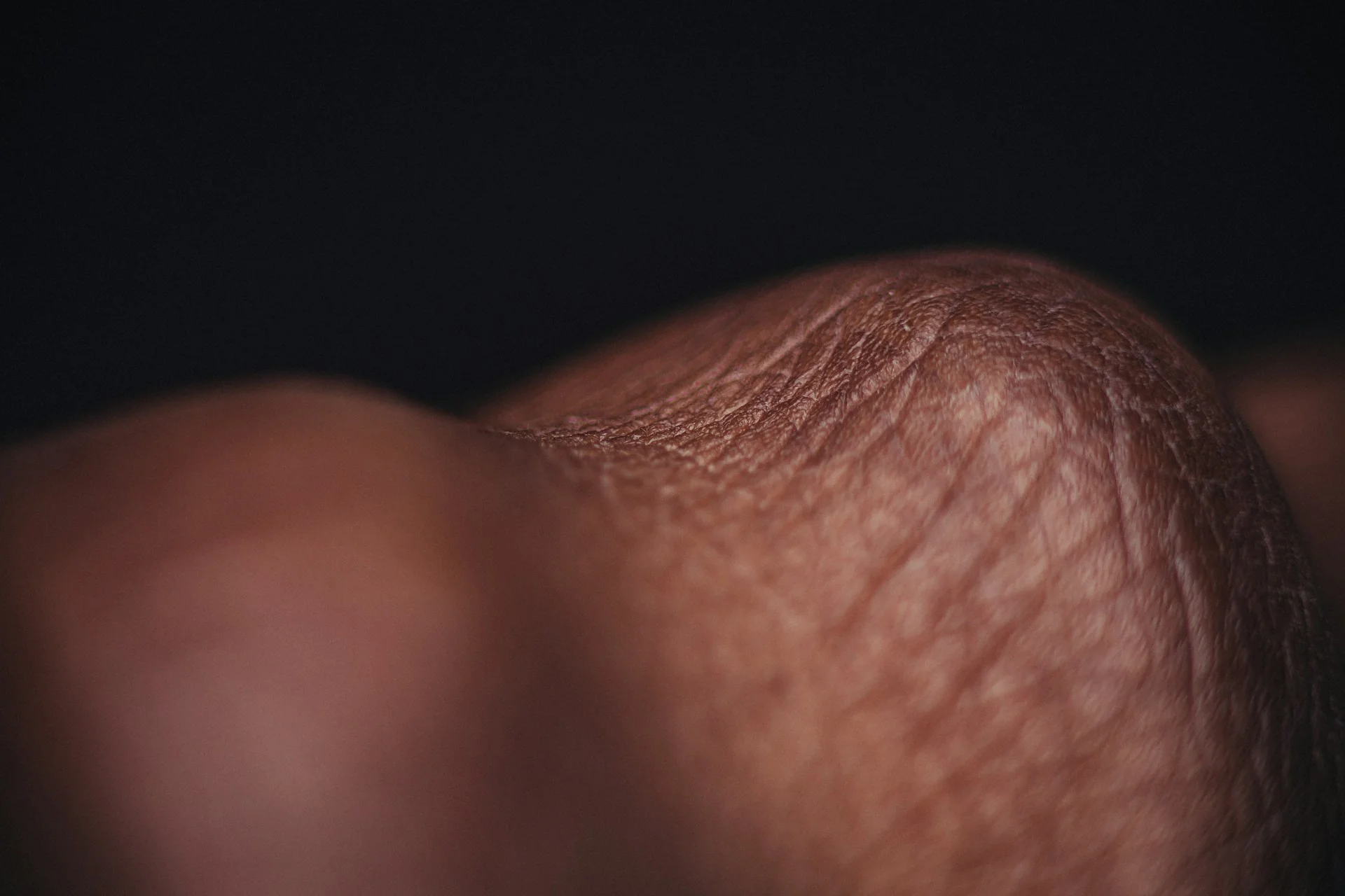 Close-up kulit kering bergaris halus dan kasar, salah satu tanda skin barrier rusak
